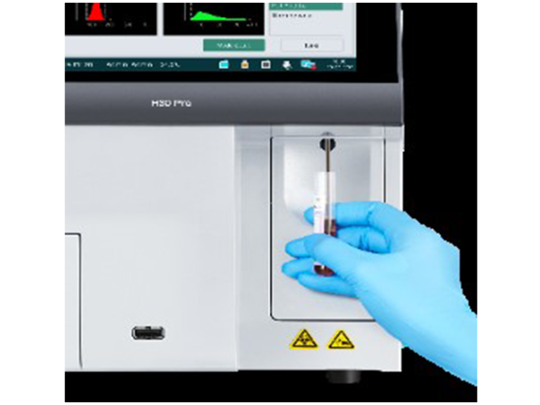 Blood Chemistry Analyzer Sains Medika Sdn Bhd