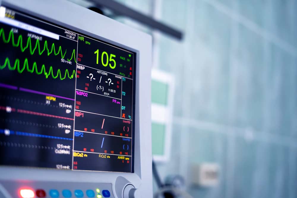 Electrocardiogram
